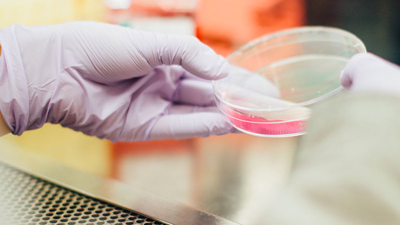 Cancer de la peau : les crèmes solaires ne serviraient à rien ? Cancer de la peau : les crèmes solaires ne serviraient à rien ?